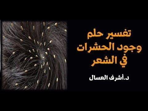 hqdefault.jpg6642cbbd86bf5.jpg688b8039ad329 - تفسير حلم رؤية حشرات في الشعر: رموز خفية؟