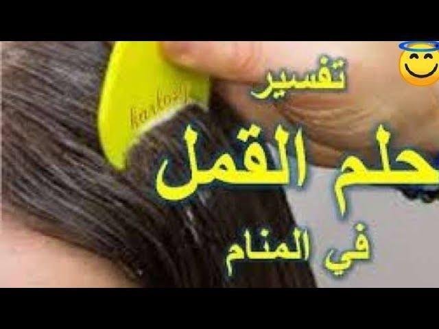 sddefault.jpg663aa98e30410 - تفسير حلم سقوط حشرات من الشعر: رموز خفية تكشفها الأحلام