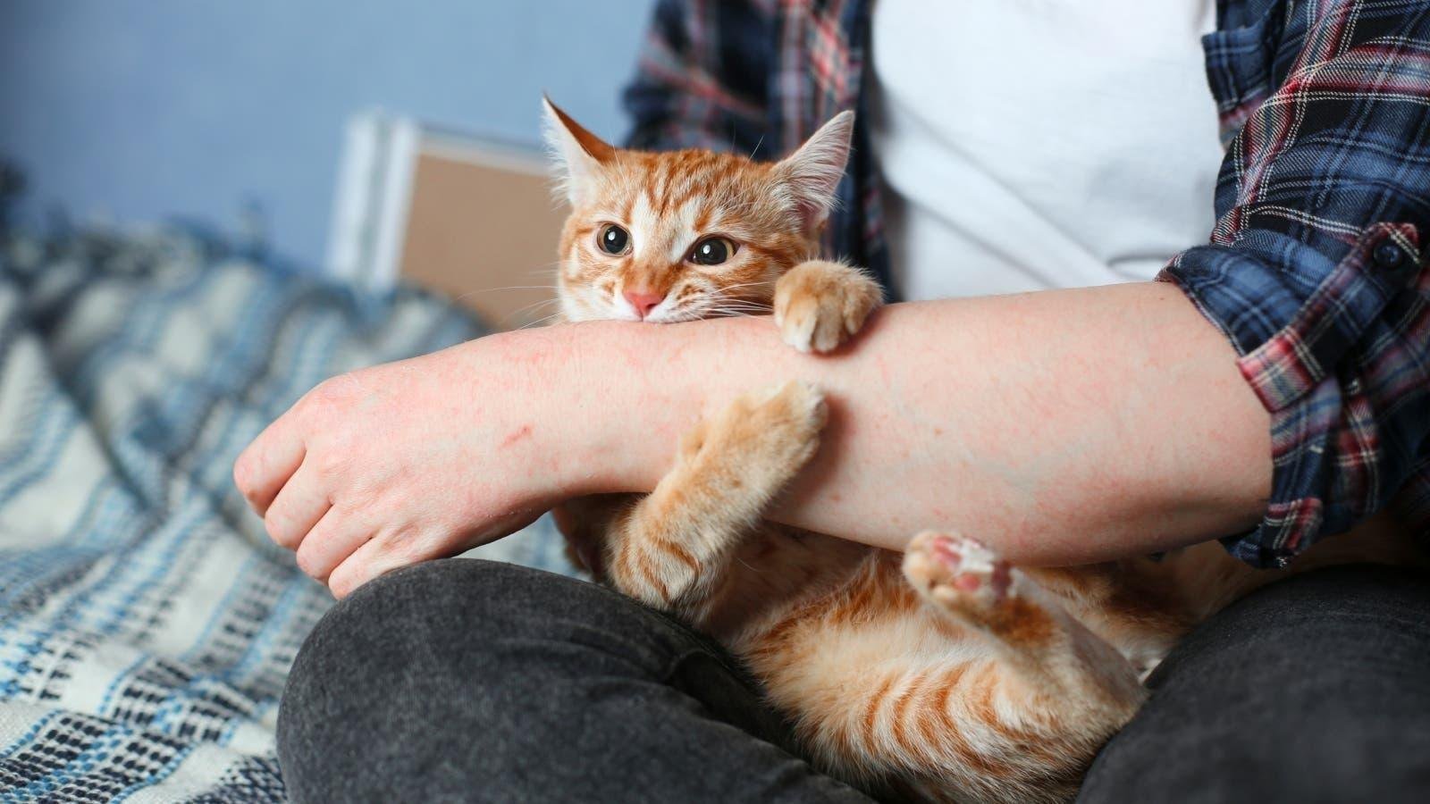 تفسير حلم قطة تخدشني في يدي اليسرى: رموز خفية؟ Cat 2520scratch.jpg6642e9a202f67 - تفسير حلم قطة تخدشني في يدي اليسرى: رموز خفية؟